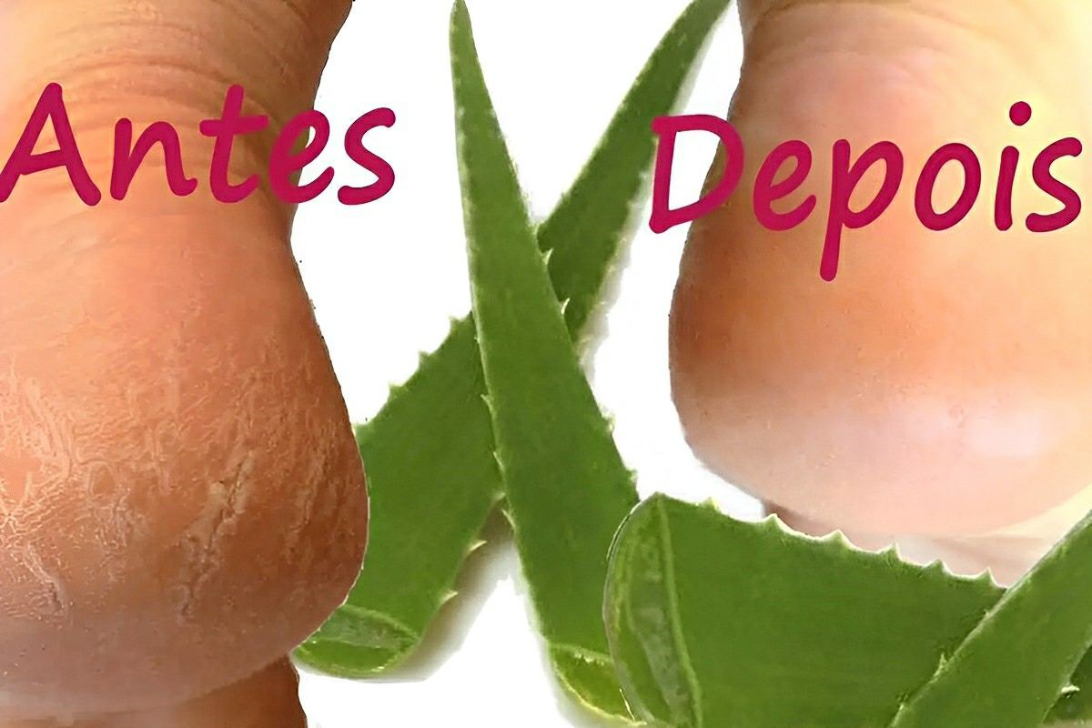 Como tirar rachaduras dos pés sem gastar muito usando apenas ingredientes naturais