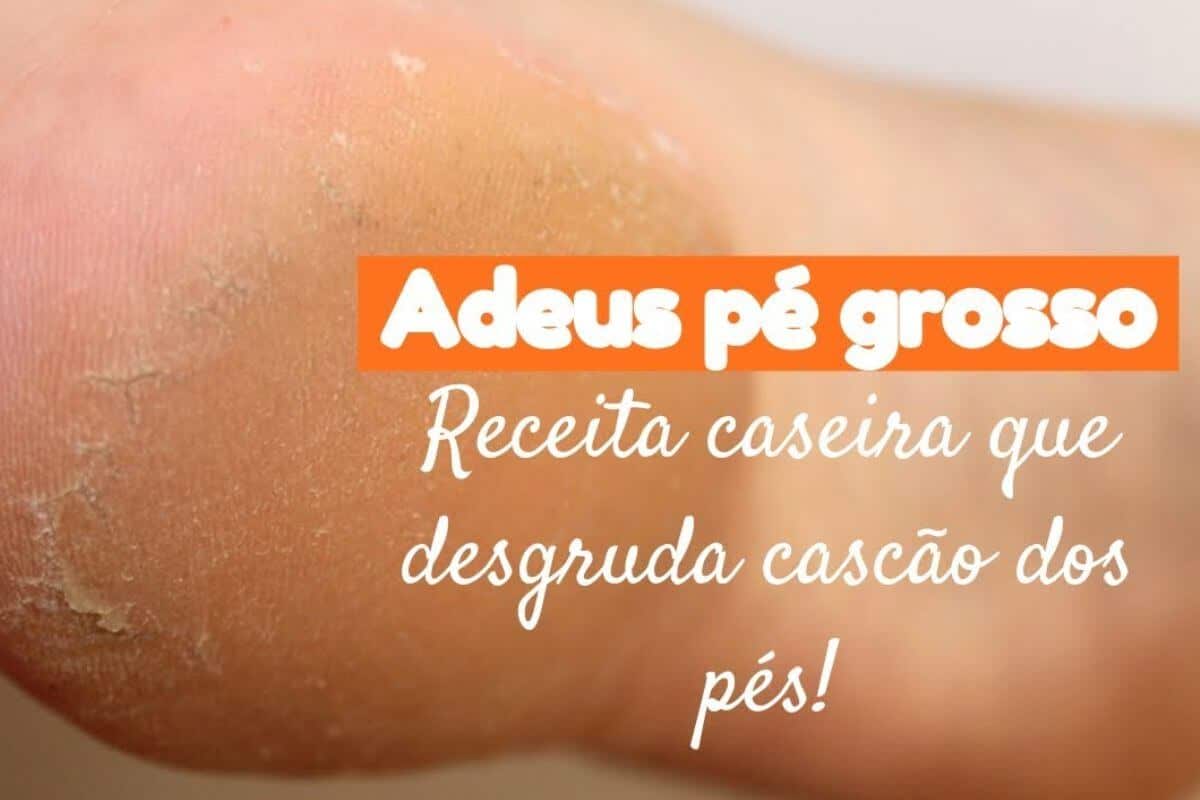 Dica para pés rachados que não falha e deixa seus pés lisinhos novamente