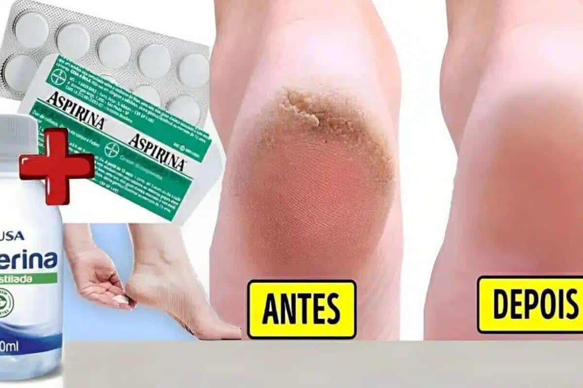 Resolva seus problemas com esse hidratante caseiro para pés rachados muito simples e eficiente