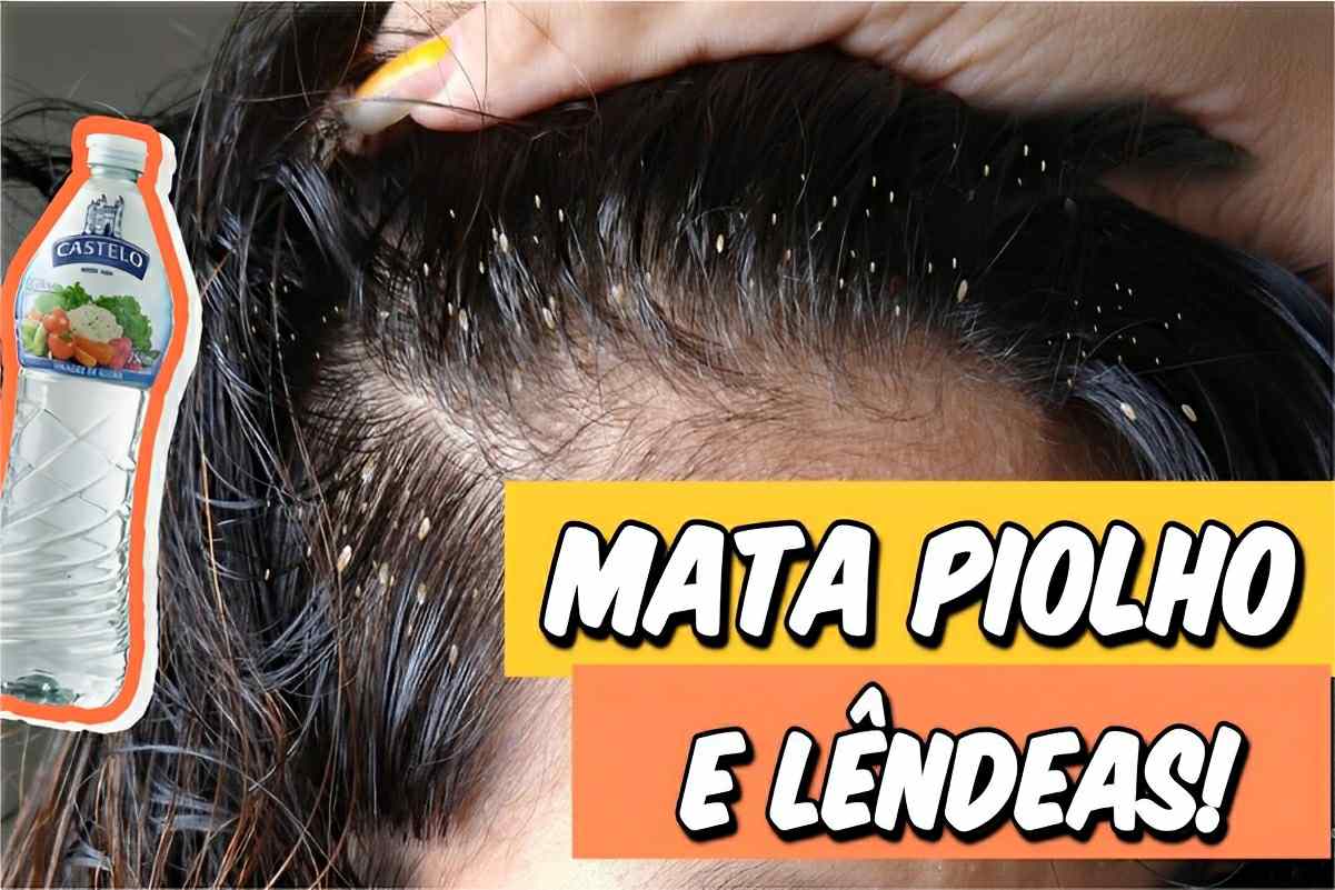 Como acabar com piolhos de um jeito muito barato e eficiente