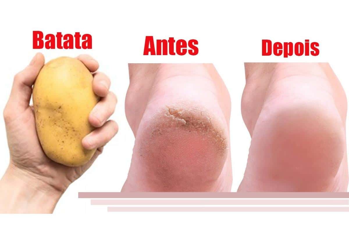 Como deixar pés lisos e sem rachaduras de um jeito super fácil e barato