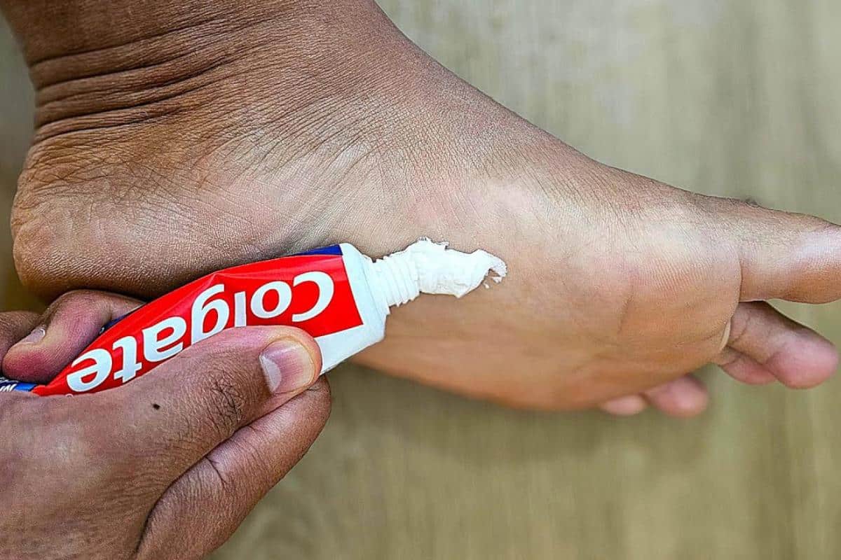 Dica para pés ressecados ficarem lisinhos e sem rachaduras sem comprar coméstico caro
