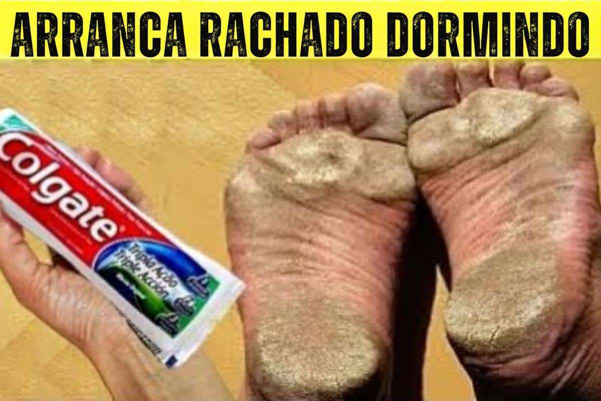Dica para pés rachados e com calos: seus pês vão ficar lisinhos novamente