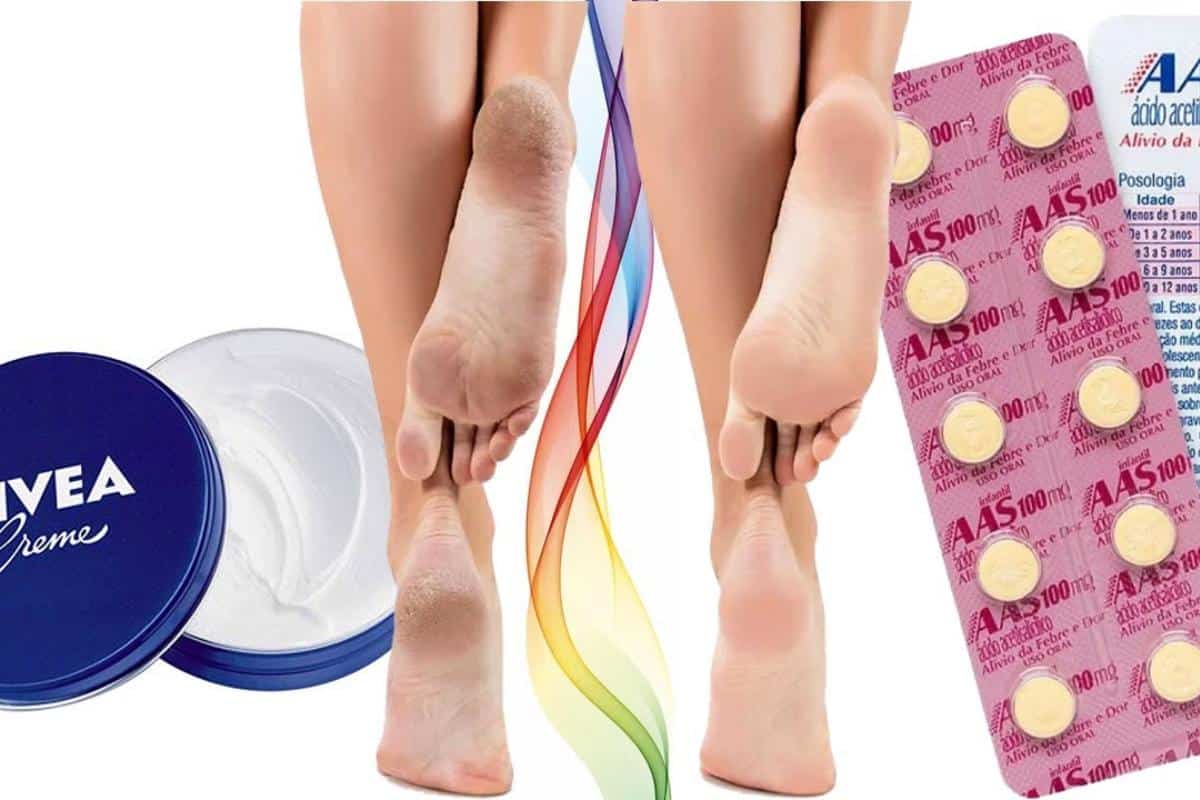 Dica para pés rachados: nunca mais você terá pés ressecados e com calosidades
