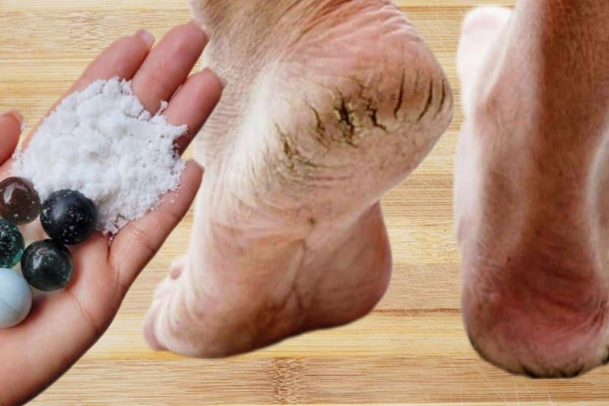 Dica para pés rachados e ressecados: seus pés vão ficar lisinhos parecendo pés de bebê
